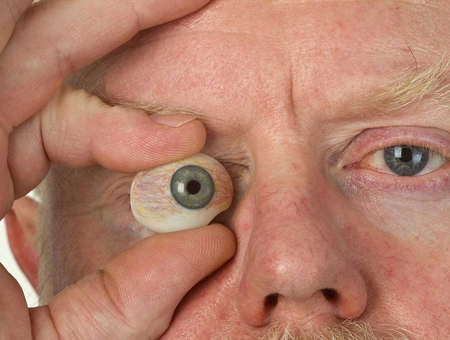 3D Custom Made Artificial Eyes In Mumbai